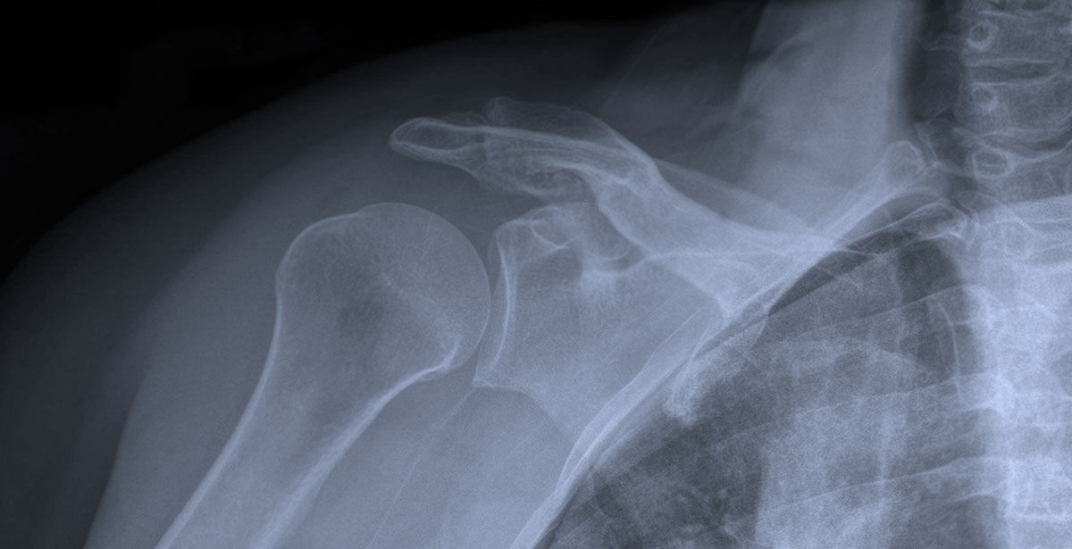 Varex Imaging