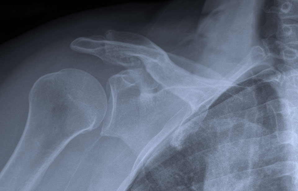 Varex Imaging