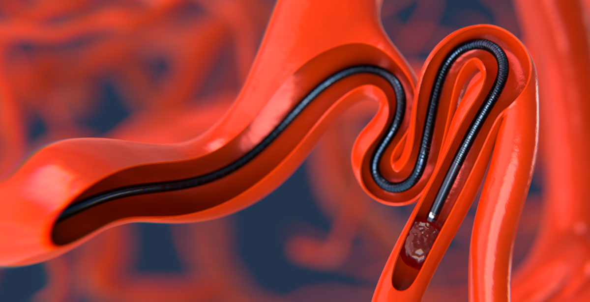 Scientia Vascular
