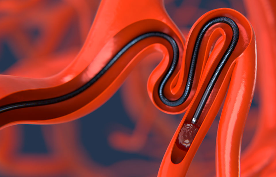 Scientia Vascular