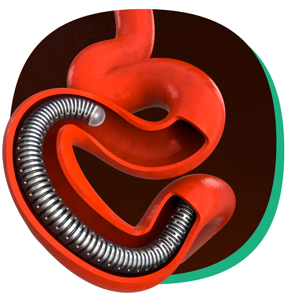 Scientia Vascular - Image 10